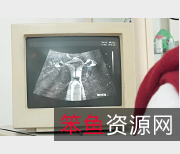 医院B超CC神秘地带：奇葩剧情，怼脸上演技燃爆，热度飙升，观看不容错过